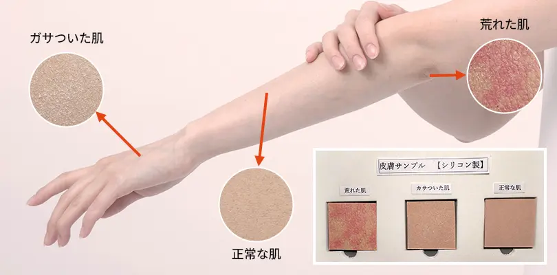 人体モデル、肌質キットの画像