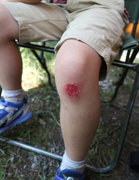 ジョンソン・エンド・ジョンソンのサムネイル