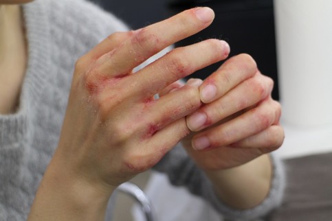 ロート製薬の写真1