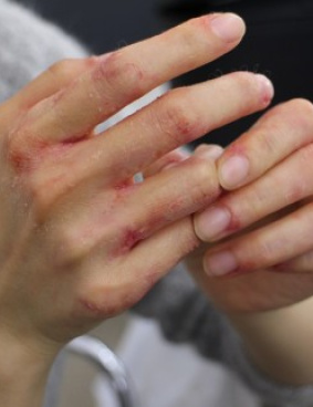 ロート製薬のサムネイル