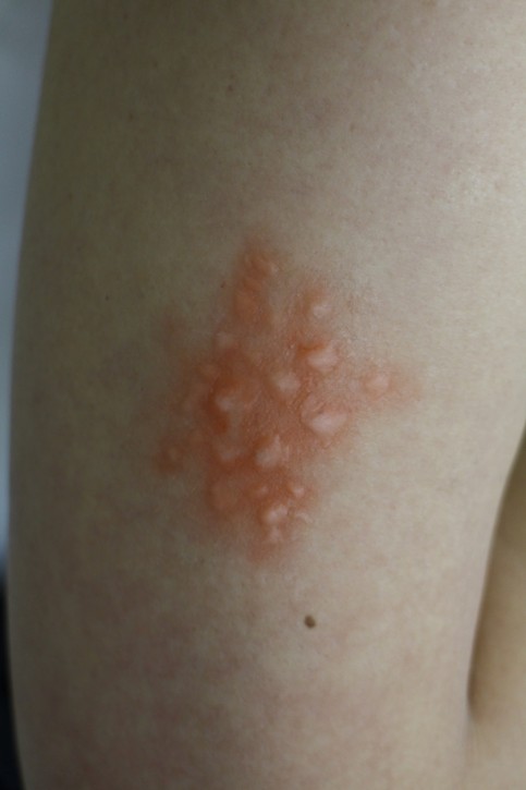 ロート製薬の写真2