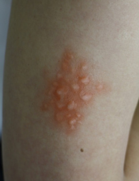 ロート製薬のサムネイル