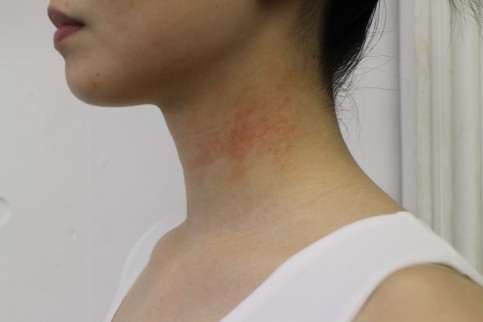 ロート製薬の写真3