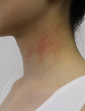 ロート製薬のサムネイル