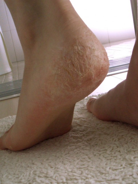 小林製薬 間宮アロエ軟膏の写真1