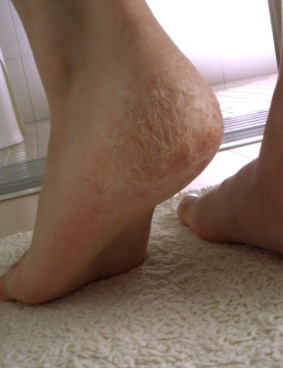 小林製薬 間宮アロエ軟膏のサムネイル