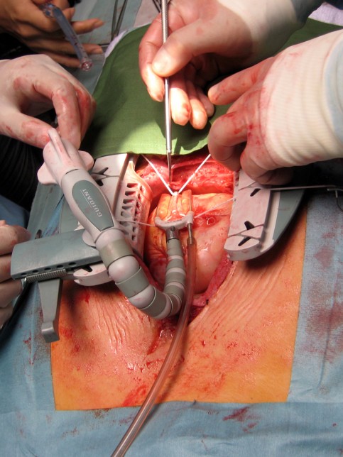 NHK「使命と魂のリミット」の写真1