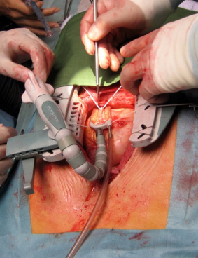 NHK「使命と魂のリミット」のサムネイル