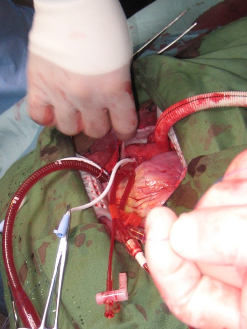 NHK「使命と魂のリミット」の写真2