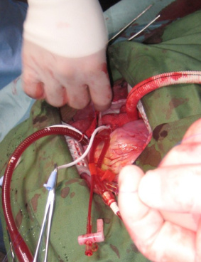 NHK「使命と魂のリミット」のサムネイル