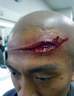 TBS「JIN-仁-」のサムネイル