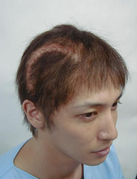 変身のサムネイル