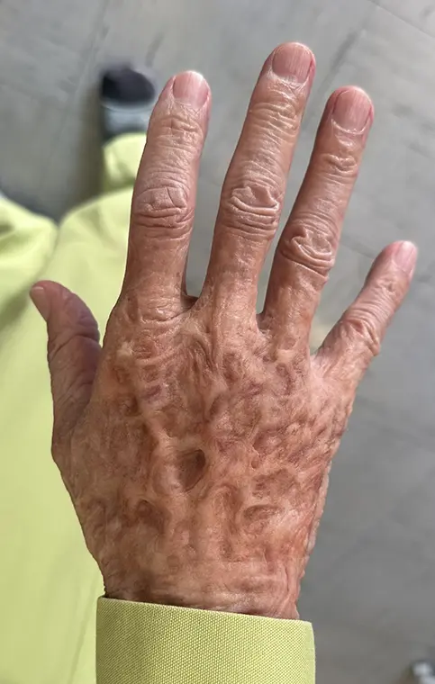 Netflix「地面師たち」のサムネイル