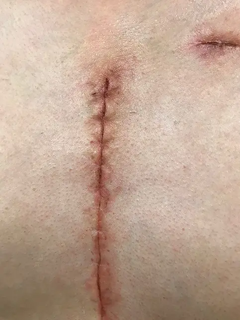 日テレ「世界仰天ニュース」のサムネイル