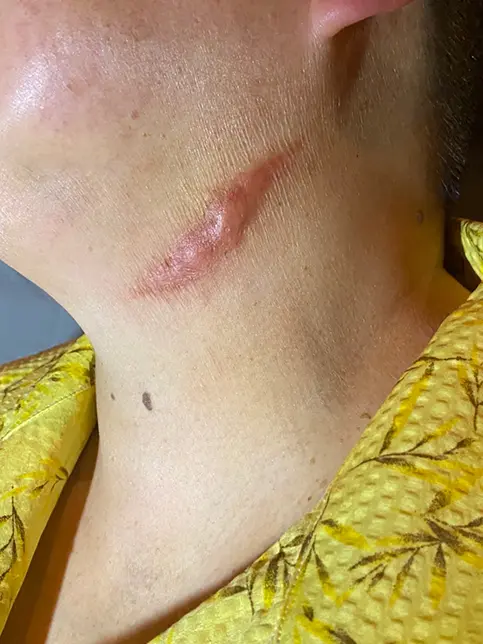 Apple TV＋「サニー」のサムネイル