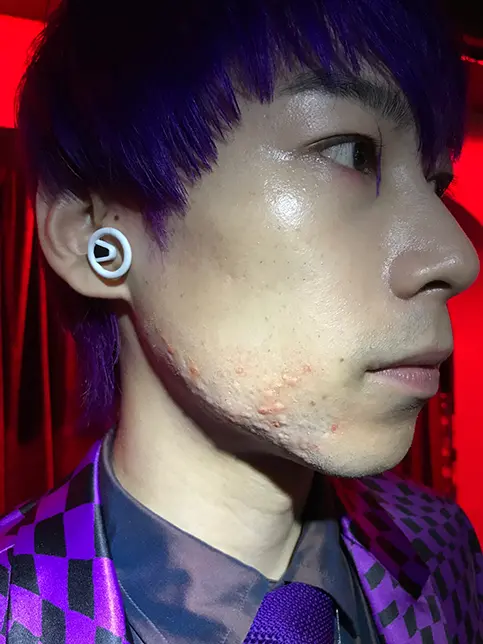 Apple TV＋「サニー」のサムネイル