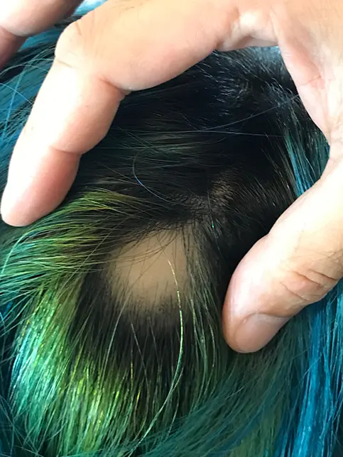 AppleTV＋「サニー」のサムネイル