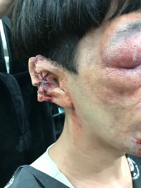 AppleTV＋「サニー」のサムネイル